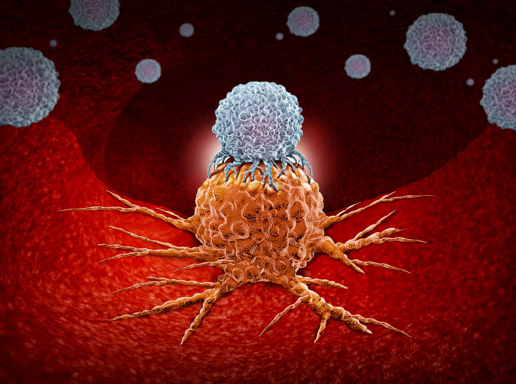 Getty Images This artist rendering shows a depiction of an immune system cell attacking a cance ...