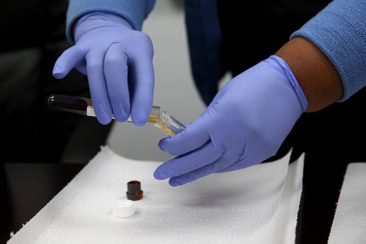 K.M. Cannon/Las Vegas Review-Journal Phlebotomist Dana Duncan, 37, separates serum from blood d ...