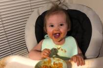Hadley's Journey Facebook page One-year-old Hadley Murphy is scheduled to undergo another heart ...